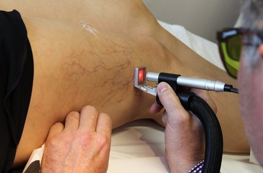 Radiação a laser