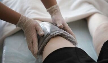 Métodos folclóricos de tratamento de varizes em mulheres